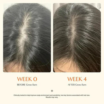 Hair GrowthSerumwith Built in Brush for Hair Growth & Thickening