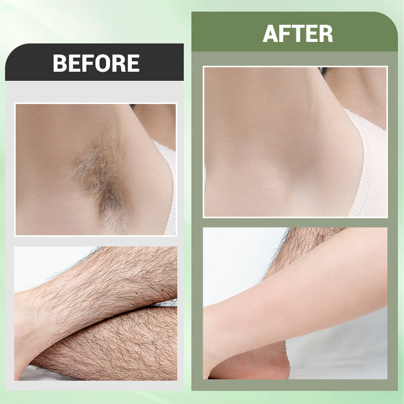 ⏳Limited time 50% discount💥3PCS Hair Removal Cream Set for Full Body